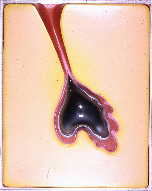 Image 6-4